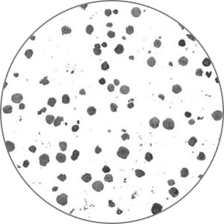 Microscopic image of the microstructure of nodular iron.